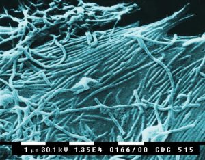 SEM of Ebola