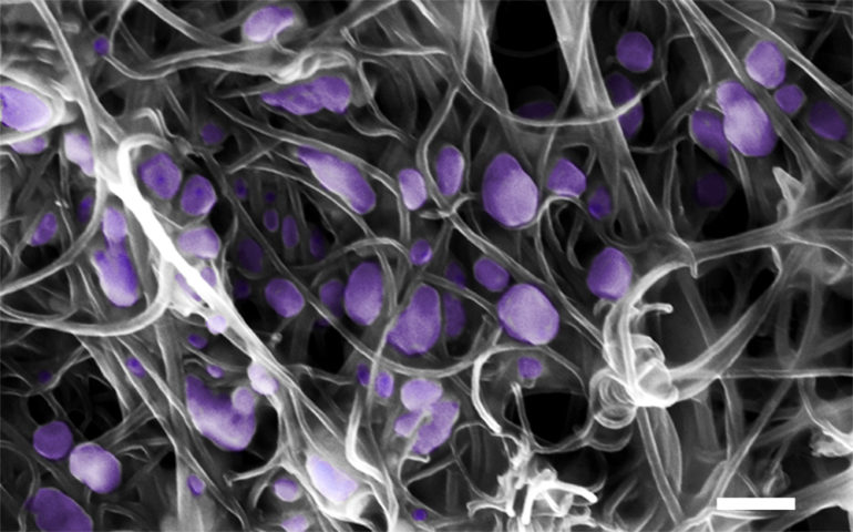 Scanning electron microscope image (scale bar: 200 nm) of the H5N2 avian influenza virus (purple) trapped inside the aligned carbon nanotubes. (Credit: Penn State)